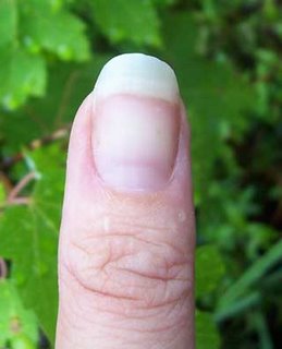 Gardener's Thumb